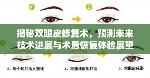 双眼皮修复术揭秘,未来技术进展与术后恢复体验展望